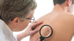 cancers-de-la-peau-mon-ennemi-c-est-le-soleil